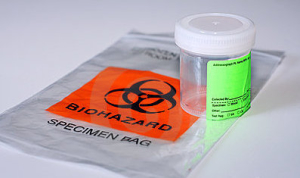 Understanding Time constraints and exceptions for delivery and processing of specimens
